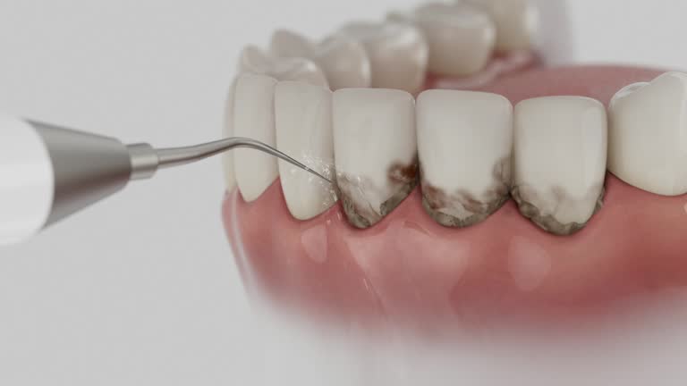 Reliable Emergency Dentist contractor in Cambrian Park, CA by Smile Center Dentistry